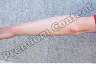 Forearm texture of street references 355 0001